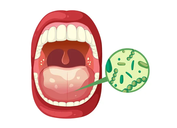 Adenotonsillectomy
