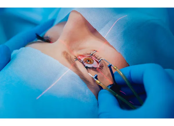 Refractive Surgery