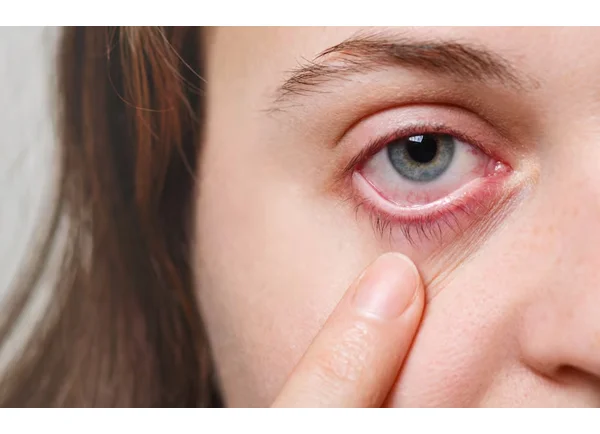 Cornea and External Disease Services